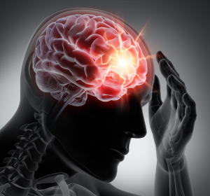 Neurologen: Migräne erhöht Risiko für Gefäßerkrankungen